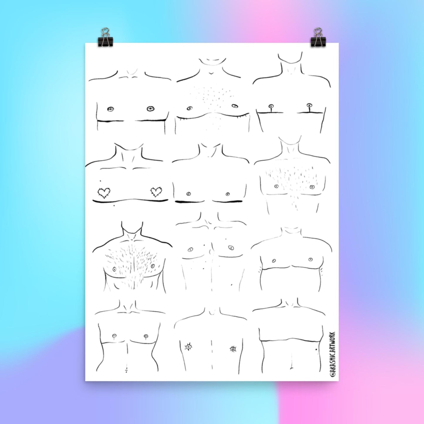 Top Surgery Poster 1