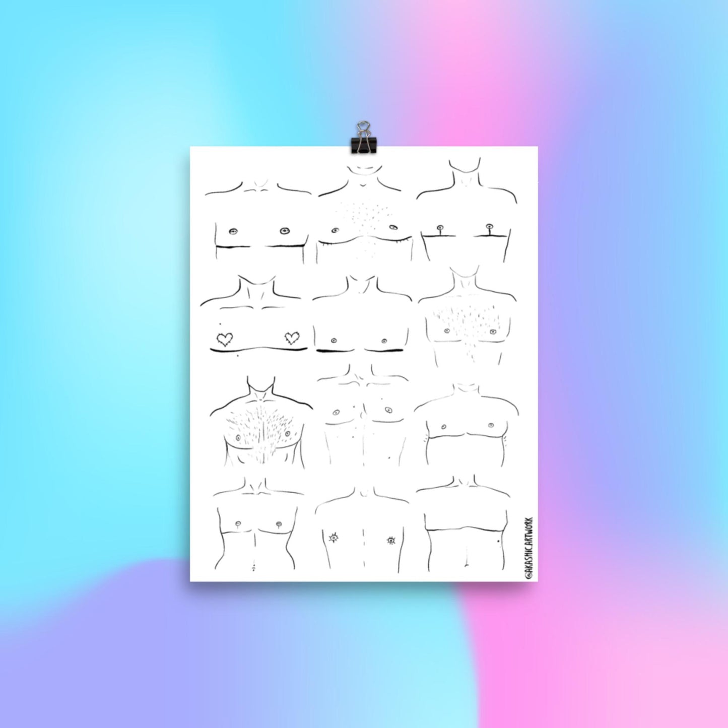 Top Surgery Poster 1